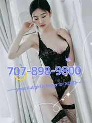 Escorts Yuba City, California Lele Skinny